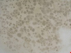 How Mold is Like a Zombie