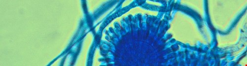 Mold Prevention During the Winter Months